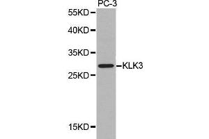 Western blot analysis of extracts of PC-3 cell lines, using KLK3 antibody. (Prostate Specific Antigen 抗体  (AA 1-100))