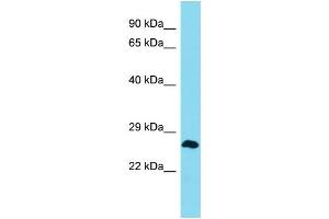 Western Blotting (WB) image for anti-MLLT4 Antisense RNA 1 (Head To Head) (MLLT4-AS1) (Middle Region) antibody (ABIN2791468)