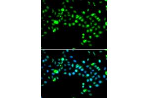 Immunofluorescence analysis of MCF-7 cells using SRSF4 antibody. (SRSF4 抗体)