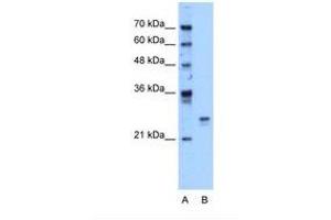 Image no. 1 for anti-High Mobility Group Box 1 (HMGB1) (AA 126-175) antibody (ABIN324443) (HMGB1 抗体  (AA 126-175))