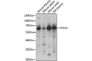 Western blot analysis of extracts of various cell lines, using PUS10 antibody (ABIN7269738) at 1000 dilution. (PUS10 抗体  (AA 290-529))