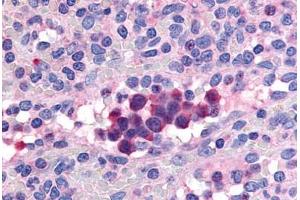 Human Spleen (formalin-fixed, paraffin-embedded) stained with PDE9A antibody ABIN213537 at 20 ug/ml followed by biotinylated goat anti-rabbit IgG secondary antibody ABIN481713, alkaline phosphatase-streptavidin and chromogen. (PDE9A 抗体  (Internal Region))