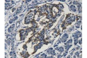 Detection of SOD3 in Human Pancreas Tissue using Polyclonal Antibody to Superoxide Dismutase 3, Extracellular (SOD3) (SOD3 抗体  (AA 19-240))