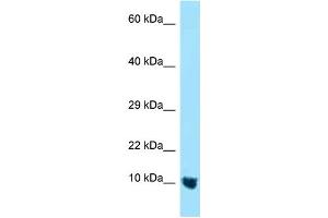 WB Suggested Anti-MTCP1NB Antibody Titration: 1. (CMC4 抗体  (N-Term))