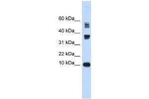 FABP3 antibody used at 1 ug/ml to detect target protein. (FABP3 抗体)