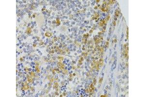 Immunohistochemistry of paraffin-embedded Rat spleen using TRAF3IP2 Polyclonal Antibody at dilution of 1:100 (40x lens). (TRAF3IP2 抗体)