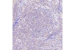 Immunohistochemistry (Paraffin-embedded Sections) (IHC (p)) image for anti-Prostaglandin F Receptor (FP) (PTGFR) antibody (ABIN7075209)