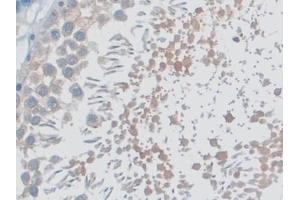 Detection of MYO1D in Rat Testis Tissue using Polyclonal Antibody to Myosin ID (MYO1D) (Myosin ID 抗体  (AA 512-788))