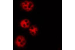 ABIN6269061 staining K562 by IF/ICC. (JAK2 抗体  (N-Term))