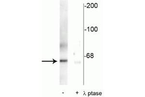 Western blot of rat synaptic membrane showing specific immunolabeling of the ~66 kDa PLK protein phosphorylated at Thr210 in the first lane (-). (PLK1 抗体  (pThr210))
