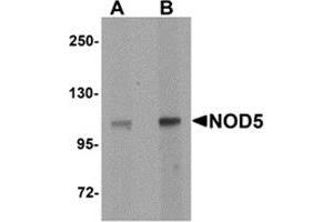 Western blot analysis of NOD5 in rat spleen tissue cell lysate with NOD5 antibody at (A) 1 and (B) 2 μg/ml. (NLRX1 抗体  (N-Term))
