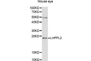 Western blot analysis of extracts of mouse eye, using LHFPL2 antibody (ABIN6294117) at 1:3000 dilution. (LHFPL2 抗体)
