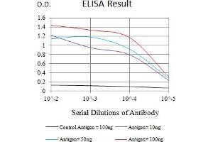 Black line: Control Antigen (100 ng),Purple line: Antigen (10 ng), Blue line: Antigen (50 ng), Red line:Antigen (100 ng) (Integrin beta 2 抗体  (AA 559-700))