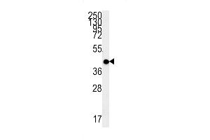 Western Blotting (WB) image for anti-Melanocortin 5 Receptor (MC5R) (AA 261-288), (C-Term) antibody (ABIN5531639)