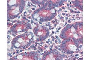 YAP1 antibody was used for immunohistochemistry at a concentration of 4-8 ug/ml.