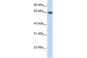 WB Suggested Anti-SLC6A2 Antibody Titration:  0. (SLC6A2 抗体  (Middle Region))