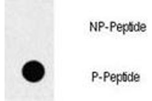 Dot blot analysis of p-EGFR antibody. (EGFR 抗体  (pTyr1069))