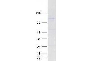 Western Blotting (WB) image for URI1, Prefoldin-Like Chaperone (URI1) (Transcript Variant 1) protein (Myc-DYKDDDDK Tag) (ABIN2730984)