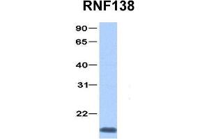 Host:  Rabbit  Target Name:  RNF138  Sample Type:  Jurkat  Antibody Dilution:  1. (RNF138 抗体  (C-Term))