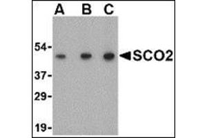 Western blot analysis of SCO2 in human liver tissue lysate with this product at (A) 0. (SCO2 抗体  (C-Term))