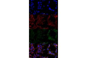 Immunocytochemistry/Immunofluorescence analysis using Mouse Anti-Hexanoyl-Lysine adduct Monoclonal Antibody, Clone 5D9 . (Hexanoyl-Lysine Adduct (HEL) 抗体 (HRP))
