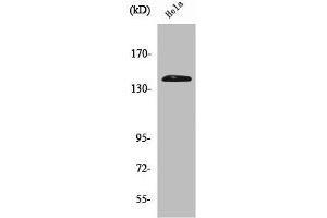 Western Blot analysis of Hela cells using PERK Polyclonal Antibody (PERK 抗体  (N-Term))