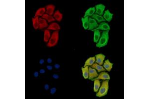 ABIN7097182 and ABIN7101250 staining Hela cells by IF/ICC. (FAM122B 抗体)