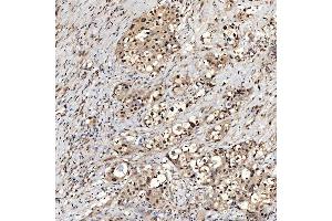 IHC analysis of SNRNP27 using anti-SNRNP27 antibody (ABIN7599614).