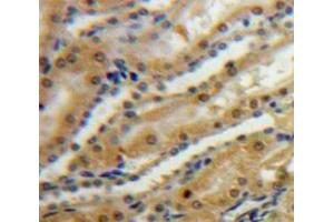 IHC-P analysis of Kidney tissue, with DAB staining. (SPARC 抗体  (AA 18-303))