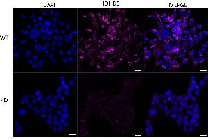 Immunocytochemical staining of HeLa cells using HDHD5 antibody (ABIN7798836), 1:1,000), Top panel: wild-type (WT), Bottom panal: HDHD5 shRNA knockdown (KD). (Recombinant Haloacid Dehalogenase-Like Hydrolase Domain-Containing 5 (HDHD5) 抗体)