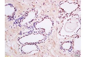 Formalin-fixed and paraffin embedded human prostate labeled with Anti-MAK (Tyr159) Polyclonal Antibody, Unconjugated  at 1:200 followed by conjugation to the secondary antibody and DAB staining. (MAK 抗体  (pTyr159))