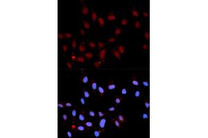 Immunofluorescence analysis of U2OS cell using Phospho-Stat3-Y705 antibody. (STAT3 抗体  (pTyr705))