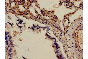 Immunohistochemistry of paraffin-embedded human lung tissue using ABIN7143430 at dilution of 1:100 (Adrenomedullin 抗体  (AA 45-92))