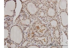 Immunoperoxidase of monoclonal antibody to RCC1 on formalin-fixed paraffin-embedded human thyroid nodular goiter. (RCC1 抗体  (AA 312-421))