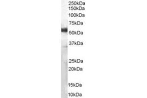 Image no. 2 for anti-CD14 (CD14) (Internal Region) antibody (ABIN374645) (CD14 抗体  (Internal Region))