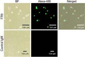 Immunocytochemical analysis of FR9 epitopes expressed on cell surface Immunocytochemical analysis was performed using Burkitt's lymphoma cells (Raji cells). (ST6GAL1 抗体)