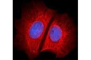 Immunofluorescence (IF) image for anti-Keratin 1 (KRT1) antibody (Alexa Fluor 647) (ABIN2657196) (Cytokeratin 1 抗体  (Alexa Fluor 647))
