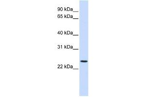 PRRG3 antibody used at 1 ug/ml to detect target protein. (PRRG3 抗体  (N-Term))