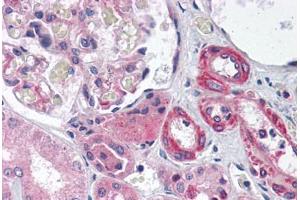 Human Kidney (formalin-fixed, paraffin-embedded) stained with GIPC1 antibody ABIN214108 at 5 ug/ml followed by biotinylated goat anti-rabbit IgG secondary antibody ABIN481713, alkaline phosphatase-streptavidin and chromogen. (GIPC1 抗体  (AA 40-89))