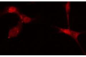 ABIN6272619 staining A549 cells by IF/ICC. (KALRN 抗体  (C-Term))