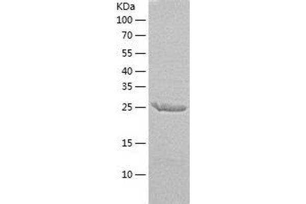 ERCC1 Protein (AA 1-273) (His tag)