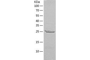 Western Blotting (WB) image for Excision Repair Cross Complementing Polypeptide-1 (ERCC1) (AA 1-273) protein (His tag) (ABIN7122859)