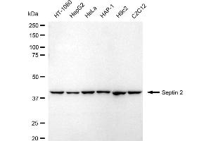 Western blotting analysis using Septin 2 antibody (ABIN7800295). (Recombinant Septin 2 抗体)