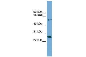 Western Blot showing ETHE1 antibody used at a concentration of 1-2 ug/ml to detect its target protein. (ETHE1 抗体  (Middle Region))