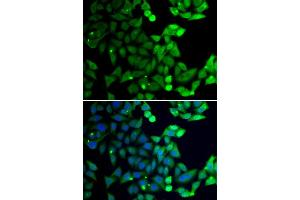 Immunofluorescence analysis of U20S cell using UIMC1 antibody. (UIMC1 抗体)