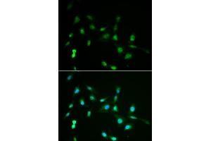 Immunofluorescence analysis of A549 cells using PIWIL4 antibody (ABIN5971612). (PIWIL4 抗体)