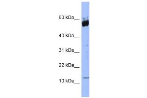 WB Suggested Anti-S100A9 Antibody Titration: 0. (S100A9 抗体  (N-Term))