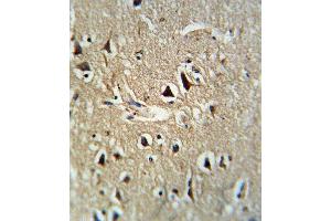 Formalin-fixed and paraffin-embedded human brain tissue reacted with PCSK2 Antibody (Center), which was peroxidase-conjugated to the secondary antibody, followed by DAB staining. (PCSK2 抗体  (AA 318-346))