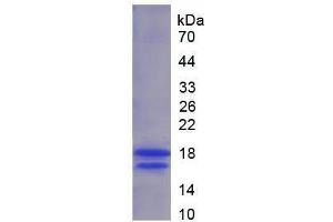 Image no. 1 for Vascular Endothelial Cell Growth Factor 121 (VEGF121) (AA 28-147) (Active) protein (His tag) (ABIN6239782)