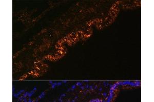 Immunofluorescence analysis of Rat lung cells using SCNN1A Polyclonal Antibody at dilution of 1:100. (SCNN1A 抗体)